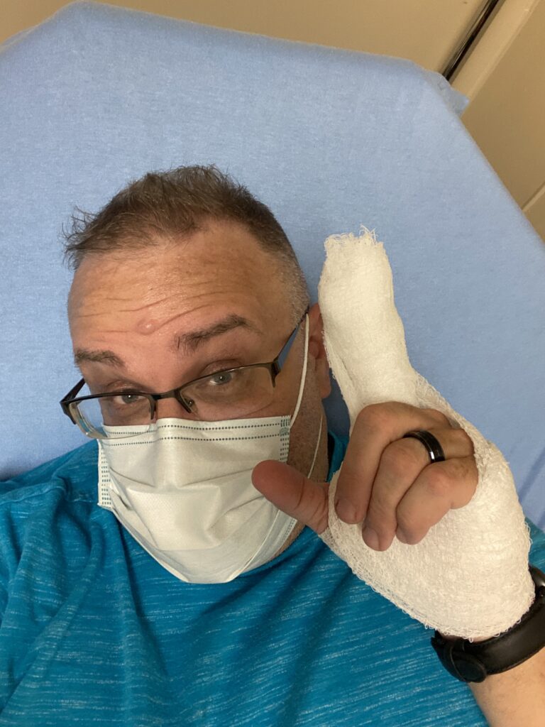 Rotary Cutters are very sharp - Just a personal public safety announcement based on a recent experience. #rotartycutter 